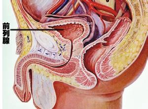 慢性前列腺炎的癥狀及其影響，慢性前列腺炎的癥狀及影響概述
